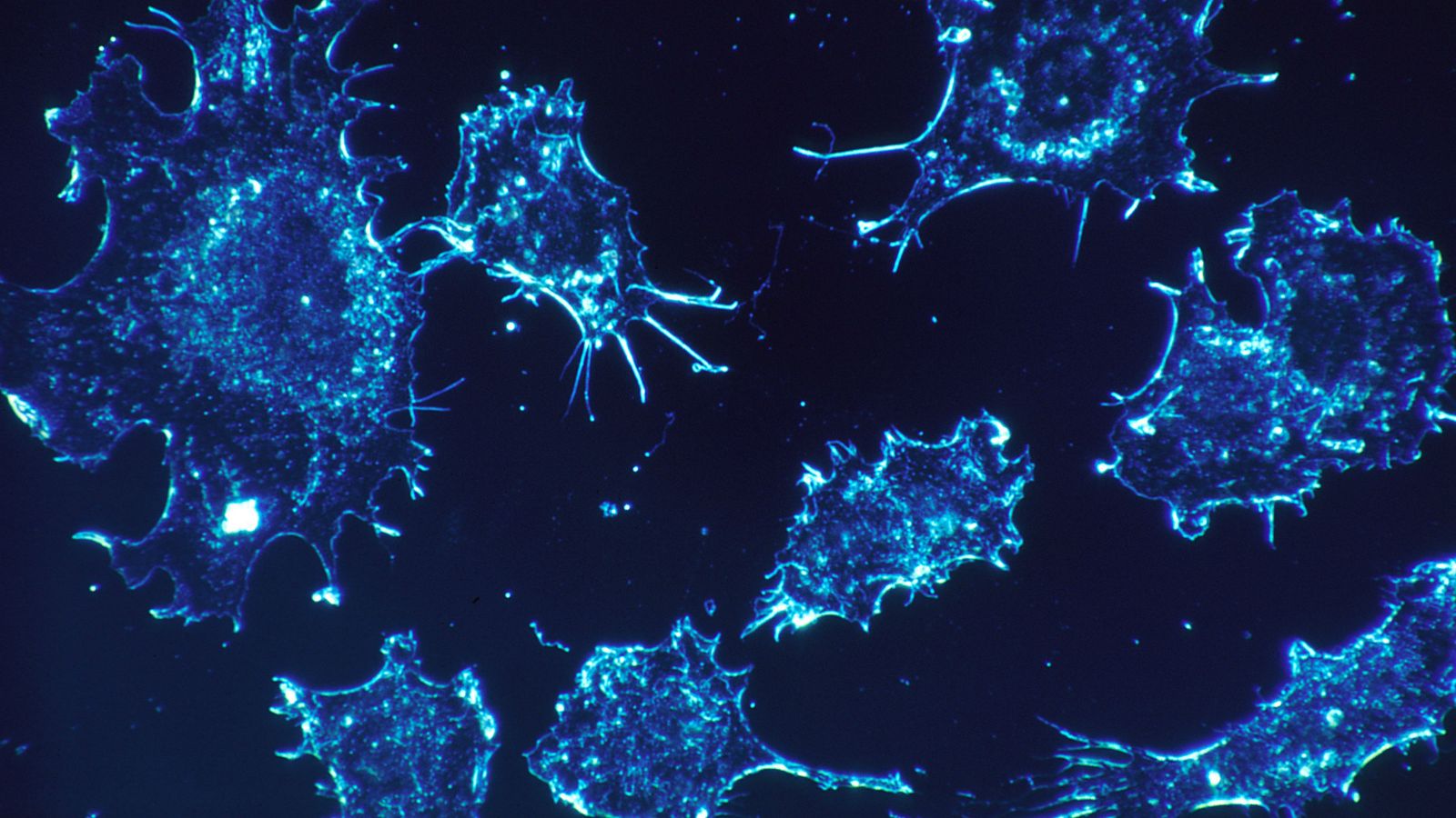 Cancer cells under microscope under a sort of blue light.