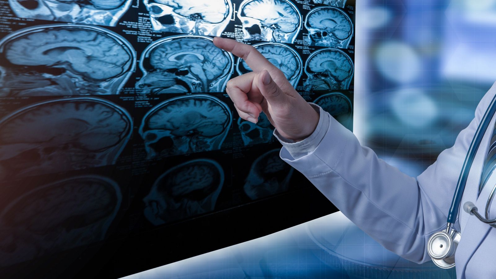 A doctor pointing their finger at CT scans of a brain