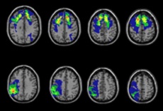 MRI scans of different areas of the brain