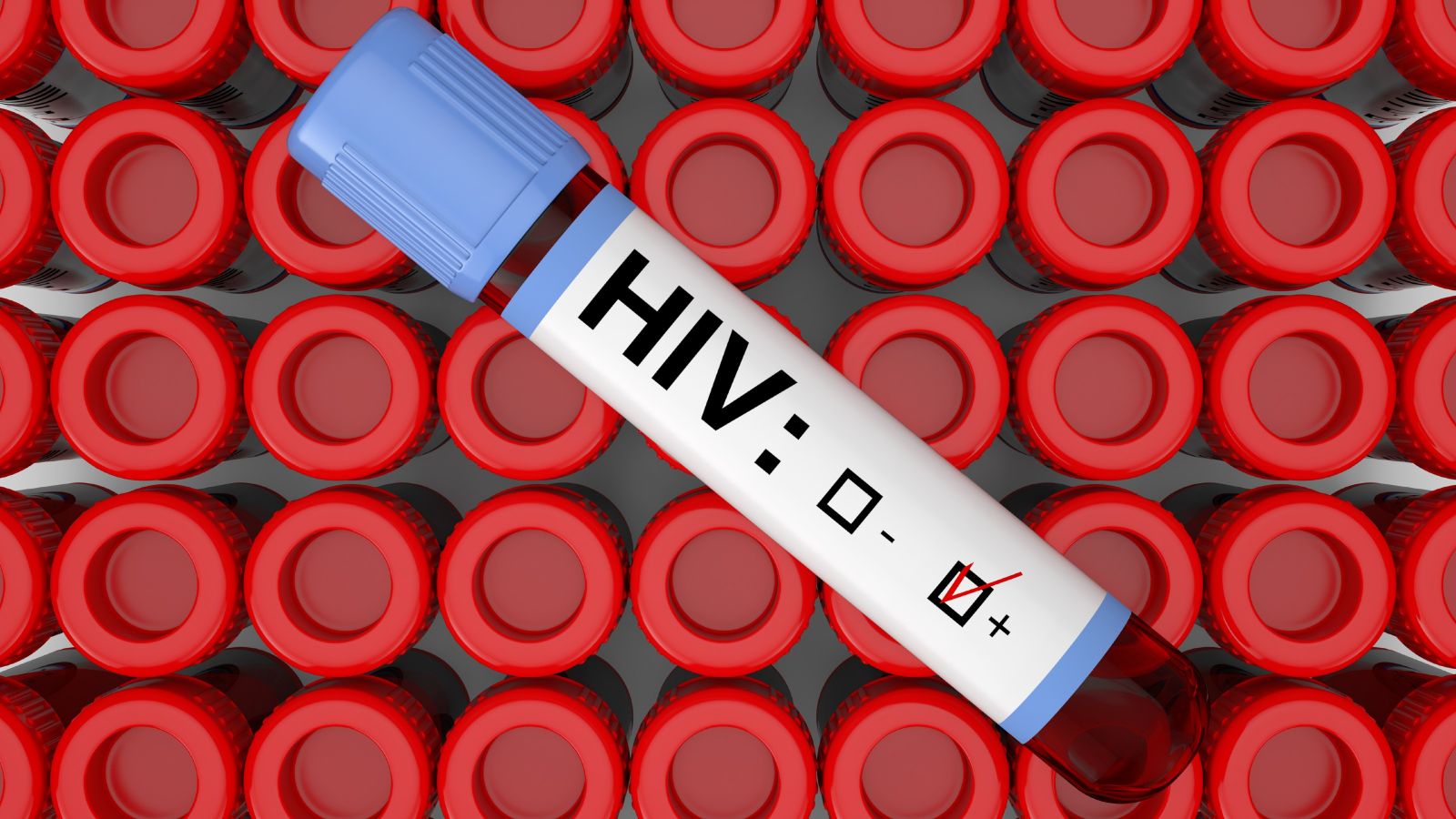 A vial of blood ticked as having tested positive for HIV