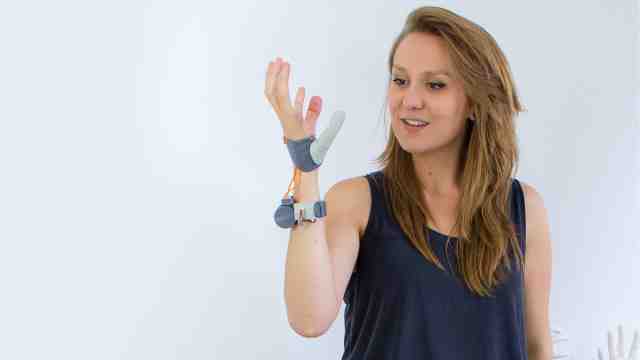 Dani Clode wearing her 3D printed prosthetic thumb