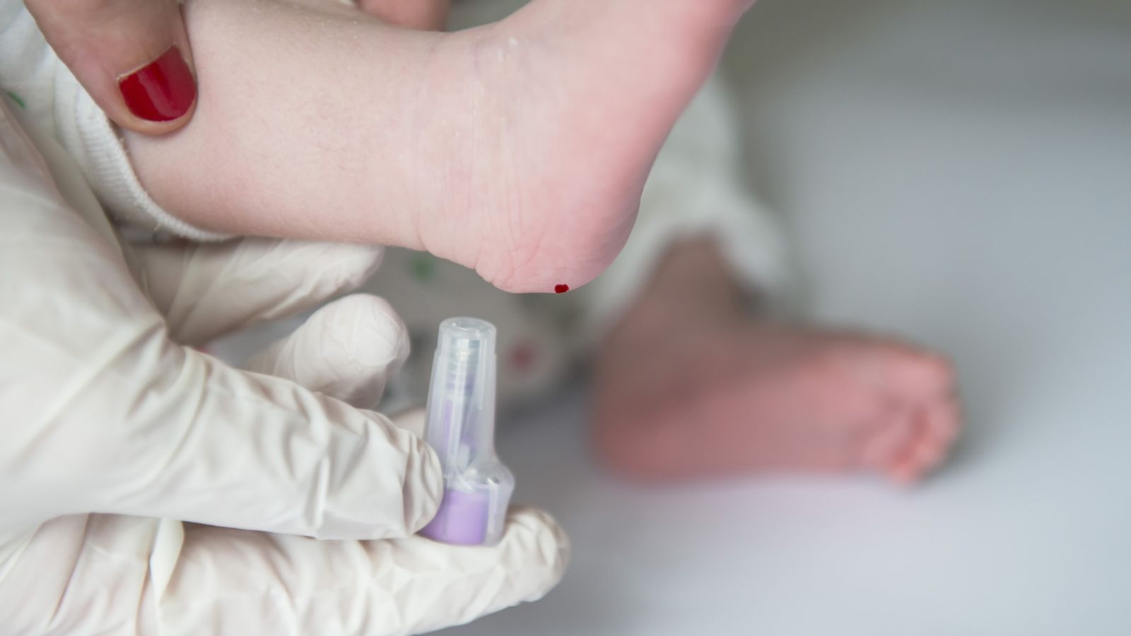 A nurse performs a 'heel prick' test on a baby