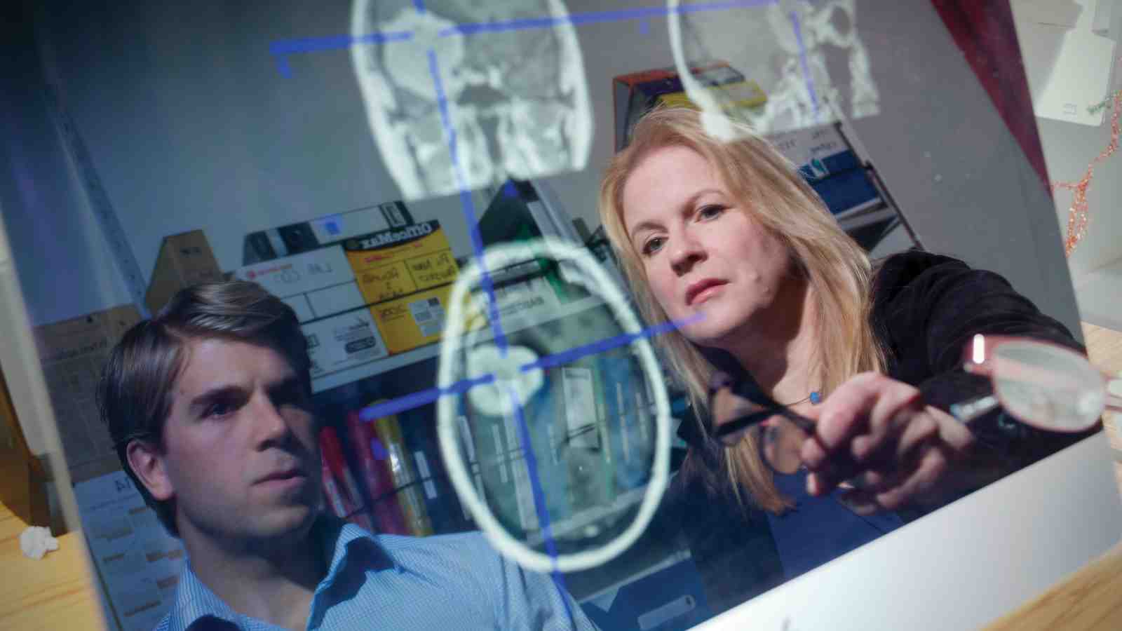 Josh Faulkner and Dr Carolyn Wilshire examining an MRI brain scan of a patient who was tested using the BLAST.