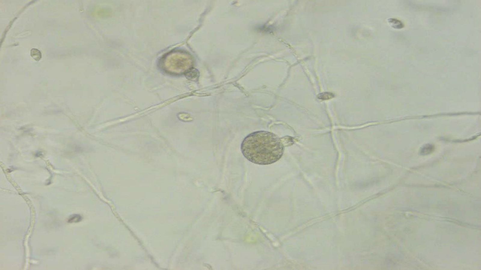 When viewed under a microscope, the complex life cycle of the pathogen becomes clear. The round structure is an oospore, which can lie dormant in the soil for years before reactivating. The small lens-shaped cells are zoospores, which swim around searching for a new tree root to infect. When they find one, they germinate and initiate an infection. The string-like fibres are mycelia, which are the actively growing structures inside an infected tree.