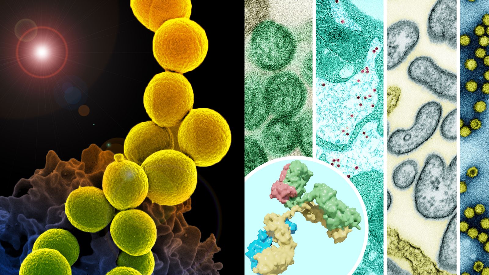 Microscopic images of staph and influenza vaccine