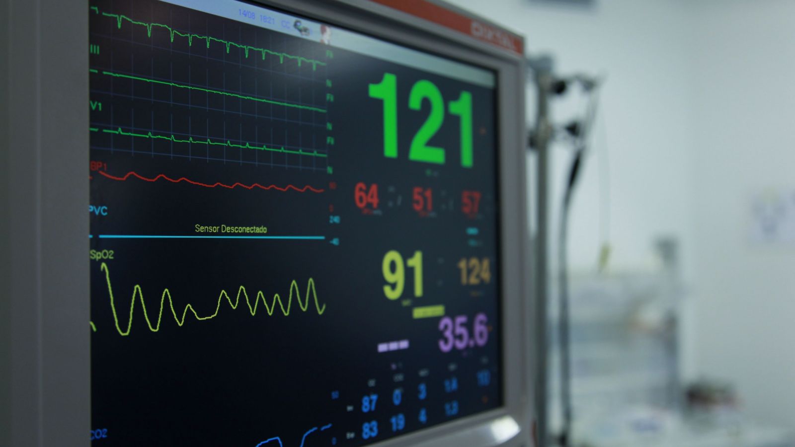 Close-up of vital signs monitor in hospital setting